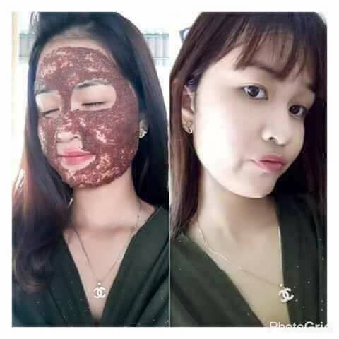 1kg hạt ngũ hoa đắp mặt hỗ trợ giảm mụn handmade | BigBuy360 - bigbuy360.vn