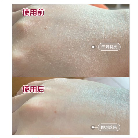 Kem dưỡng da tay Shiseido Medicated Hand Cream 100g cấp ẩm sâu chống nứt nẻ 100g