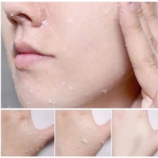 TẨY TẾ BÀO CHẾT ARRAHAN HÀN QUỐC