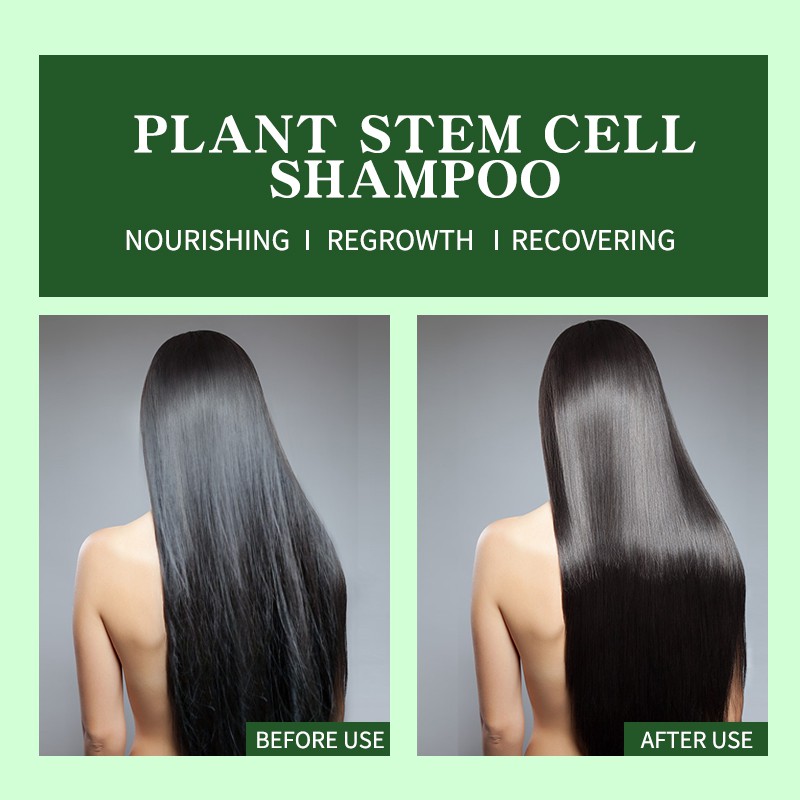 Dầu gội LIYALAN Anti Hair Loss Hair Regrowth Black Organic Plant Stem Cell Shampoo 250ml