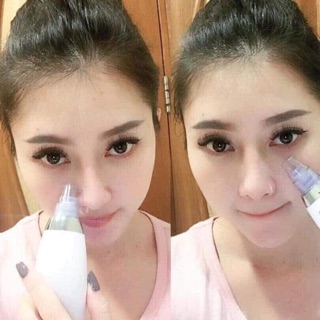 Máy hút nhân mụn black head detector