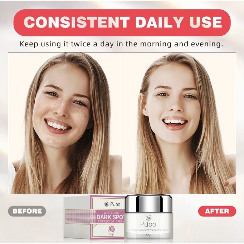 Kem trắng da xoá thâm nám, chống lão hoá Pdoo 50g USA