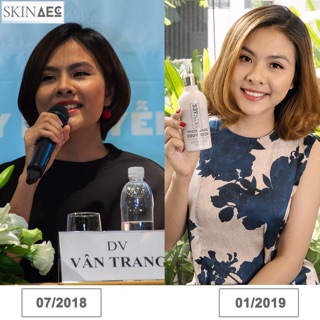 Kem kích trắng da SKIN AEC hàn quốc authentic