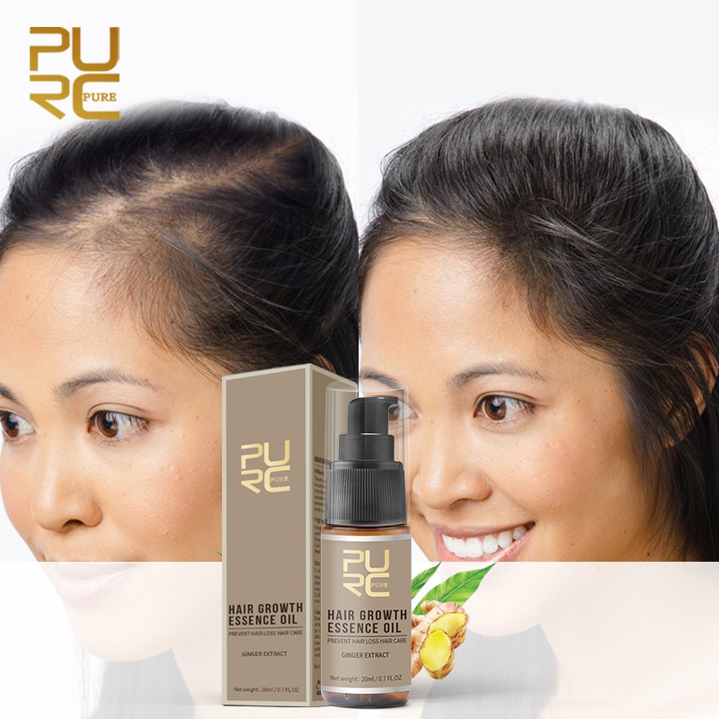 Bộ Sản Phẩm PURC Gồm Tinh Dầu Kích Mọc Tóc 20ml Kèm Dầu Gội Gừng 100ml