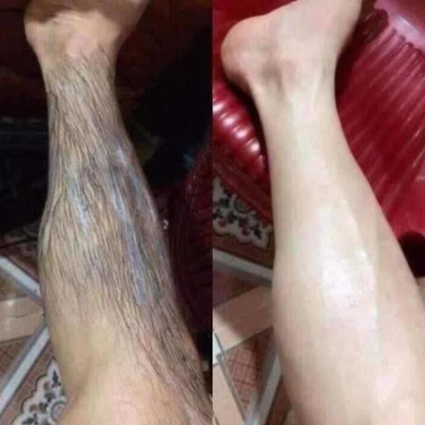 Combor Kem Tẩy Lông Huyền Phi Cao Cấp, Triệt Sạch Các Loại Lông, 100% Hàng Chính Hãng.SIÊU KHUYẾN MẠI! | BigBuy360 - bigbuy360.vn
