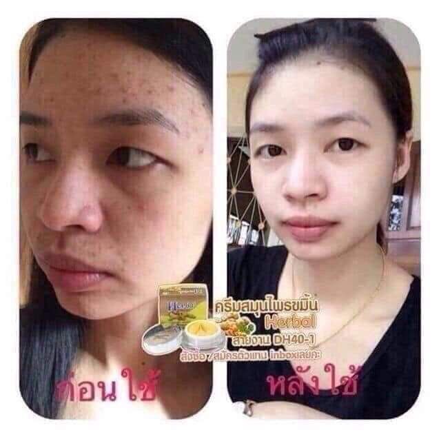 Kem nghệ Herbal ceram Thái lan