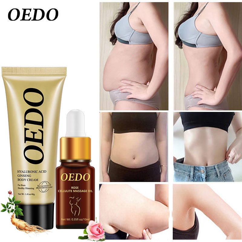 Bộ giảm béo OEDO Kem tan mỡ bụng và giảm rạn da cao cấp cam kết eo thon đốt cháy mỡ thừa làm thon gọn vùng