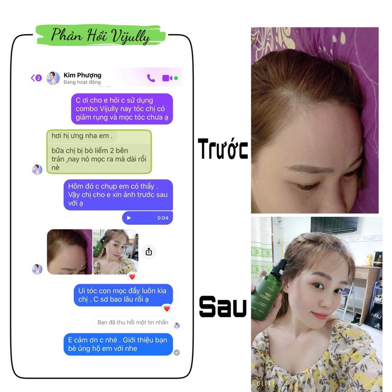 [MỌC TÓC NHANH] TINH DẦU BƯỞI XỊT TÓC VIJULLY 100ml, NGĂN NGỪA RỤNG, KÍCH THÍCH MỌC TÓC | BigBuy360 - bigbuy360.vn