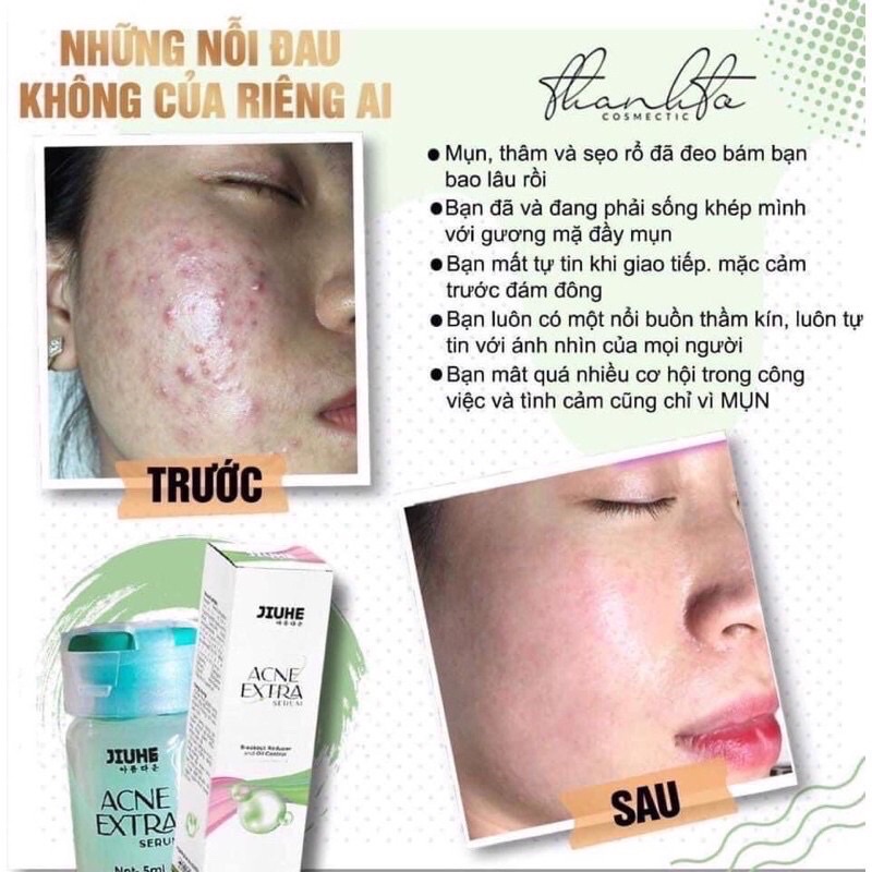 SERUM JIUHE ACNES NANO MỤN THANH TÔ CHÍNH HÃNG 100%