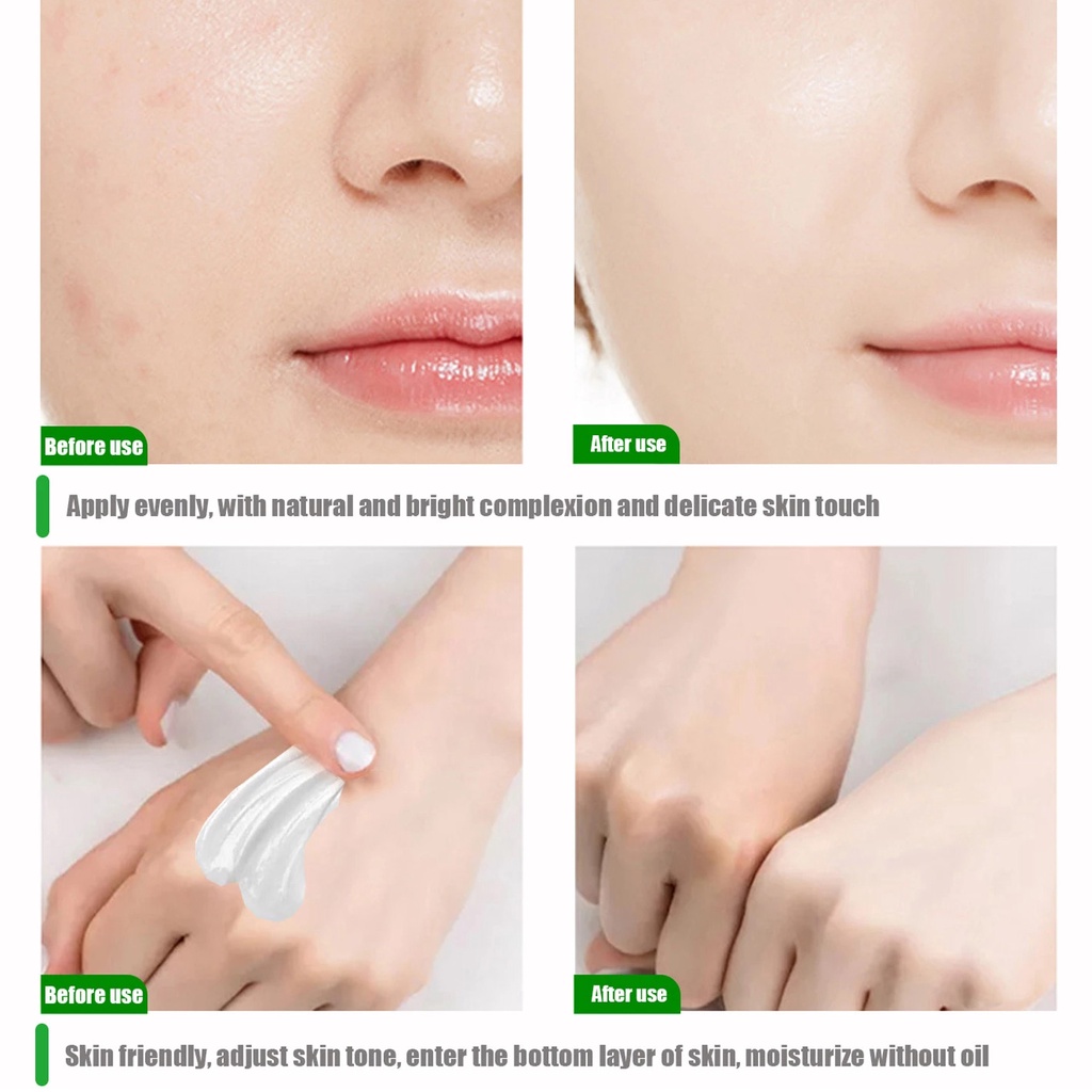 1 Kem Dưỡng Trắng Da Cải Thiện Melanin Cải Thiện Melanin Chăm Sóc Làm Sáng Da