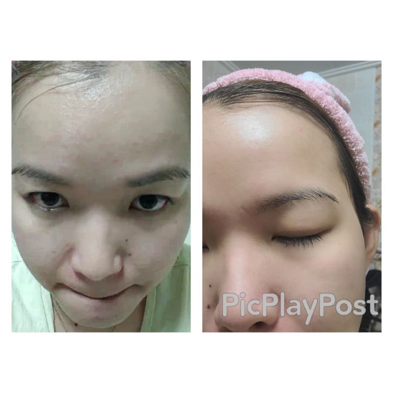 Tinh chất phục hồi te bao goc laksmira