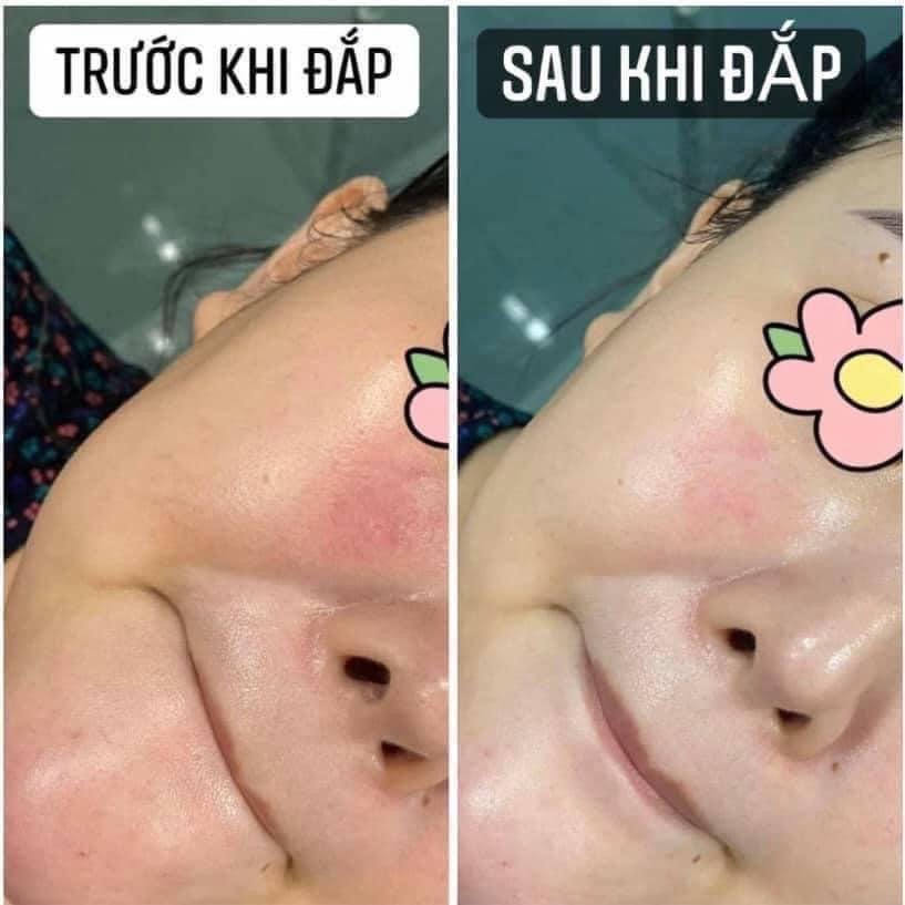 Mặt nạ dưỡng và phục hồi da SMAS Peptide Silk Mask 24H Hydration Boost 25G Nhật Bản dành cho da nhạy cảm, treatment