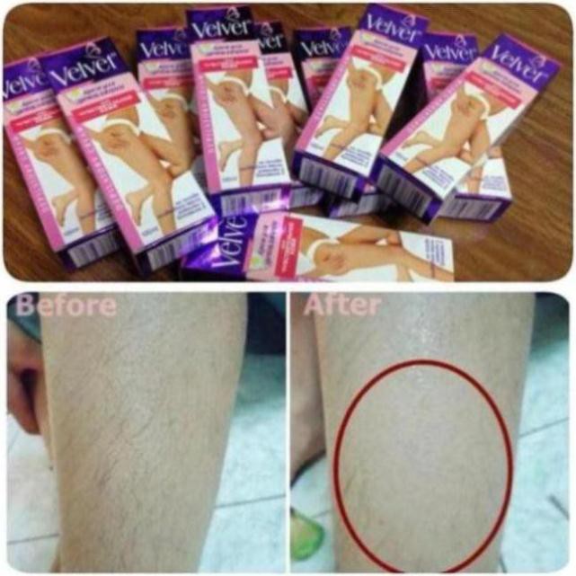 Kem tẩy lông velvet tẩy sạch lông trong 5 phút an toàn [Cam kết hàng chuẩn Nga] | BigBuy360 - bigbuy360.vn