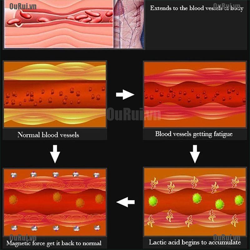 Nhẫn Nam Châm Bằng Thép Không Gỉ Chăm Sóc Sức Khỏe