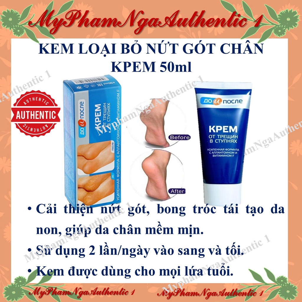 Kem nứt gót chân Nga Kpem