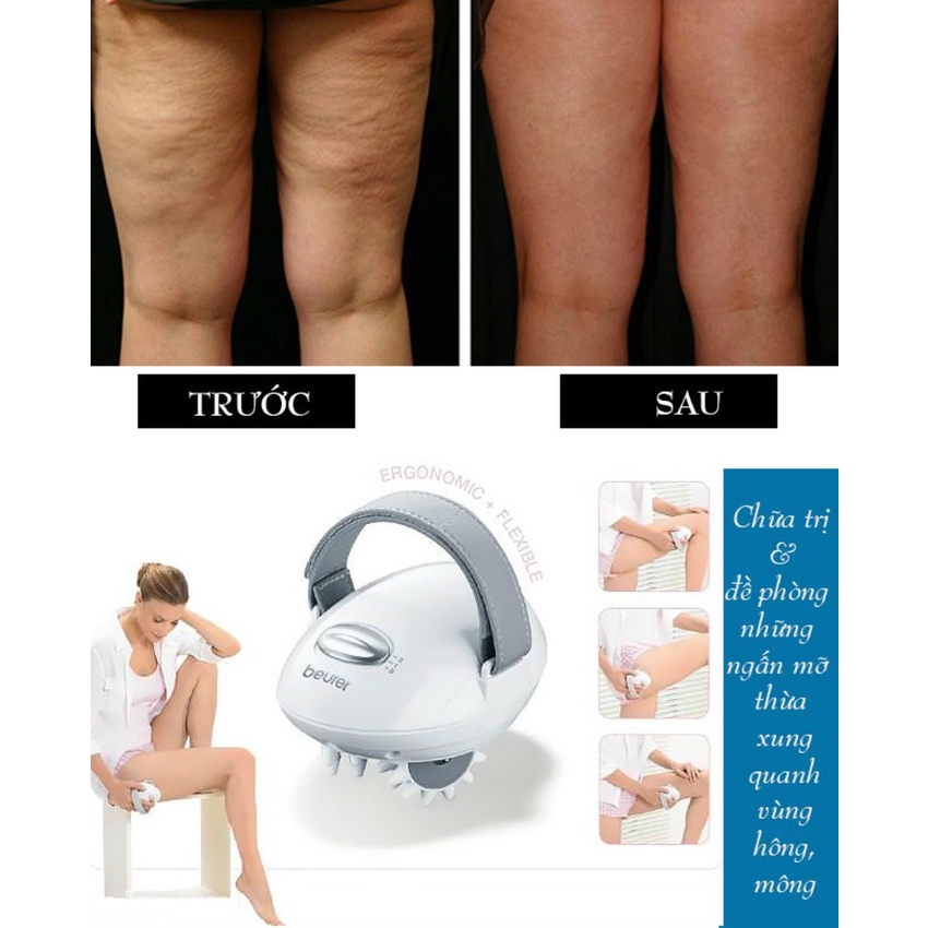 Máy massage cầm tay trị liệu bệnh Cellulite Beurer CM50 - Hàng chính hãng