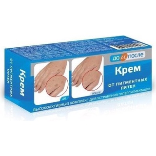 Kem kpem bôi tay đồi mồi và đốm nâu da - nga