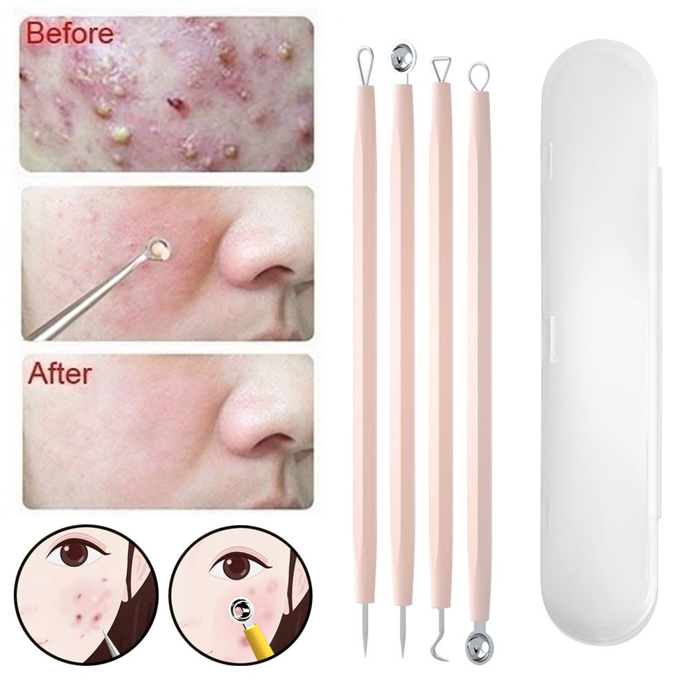 [Hàng mới về] Set dụng cụ nặn mụn hai đầu bằng thép không gỉ nhiều màu sắc tùy chọn