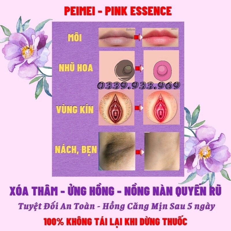 Chống Thâm Môi - Làm Hồng Môi - Làm Hồng Nhũ Hoa - Làm Hồng Vùng Kín Sexy Pink Aichun Beauty 30g