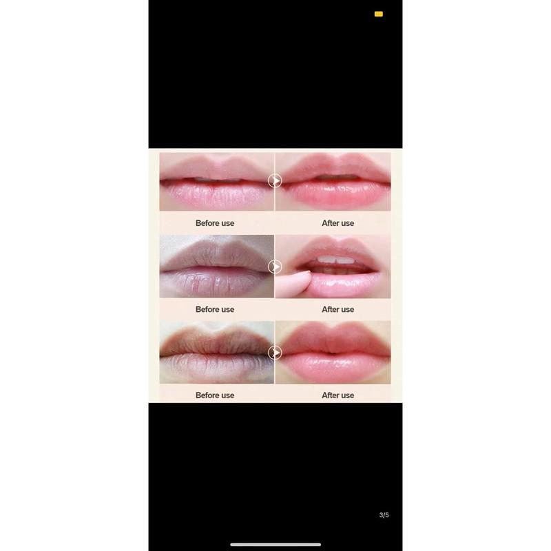 [HÀNG SẴN] Mask môi, mặt nạ môi Hi.ISEES | BigBuy360 - bigbuy360.vn