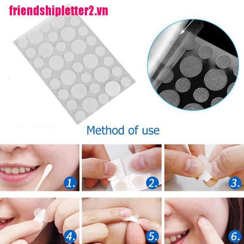 (Hàng Mới Về) Set 36 Miếng Dán Trị Mụn Chăm Sóc Da Hiệu Quả | BigBuy360 - bigbuy360.vn