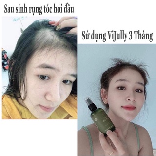 XỊT BƯỞI MỌC TÓC 𝑽𝑰𝑱𝑼𝑳𝑳𝒀  chai 100ml