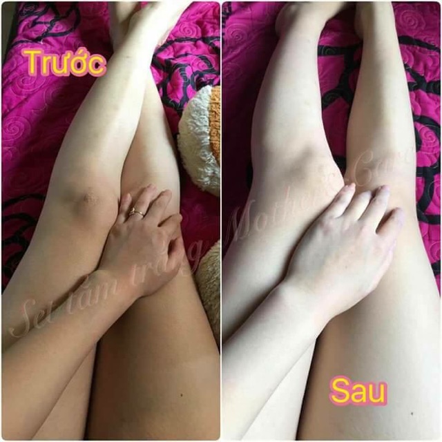 Sét Tắm Trắng Body Mother & Care