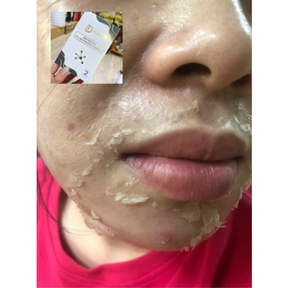 Peel da retinol vi tảo - trang nemo.