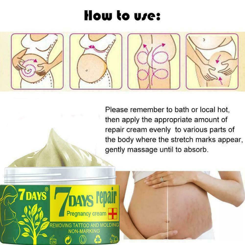 [Hàng mới về] Kem phục hồi vết rạn da tiện dụng cho vùng bụng Q1Q6 C4V4