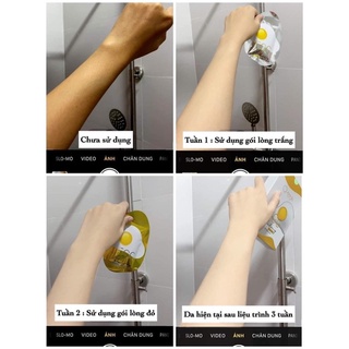 TẮM TRẮNG TRỨNG GÀ