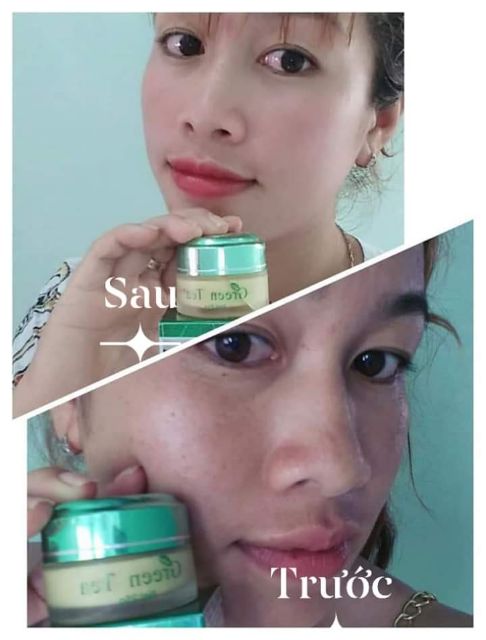 KEM FACE trà xanh Green Tea