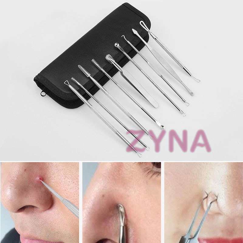 Bộ dụng cụ nặn mụn đầu đen bằng thép không gỉ