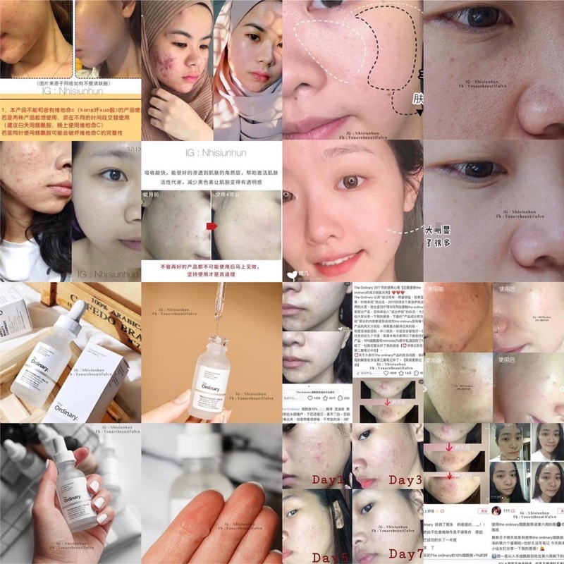 Serum The Ordinary Niacinamide 10% + Zinc 1%