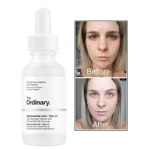 ️ Tinh chất Niacinamide 10% + Zinc 1% - The Ordinary | BigBuy360 - bigbuy360.vn