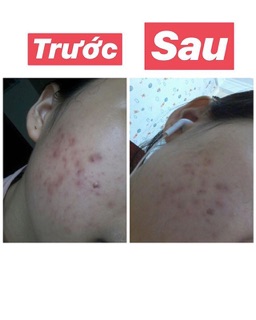 [SALE] bột diếp cá gói lớn