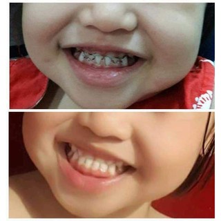 Kem đánh rắng trắng sáng AP24