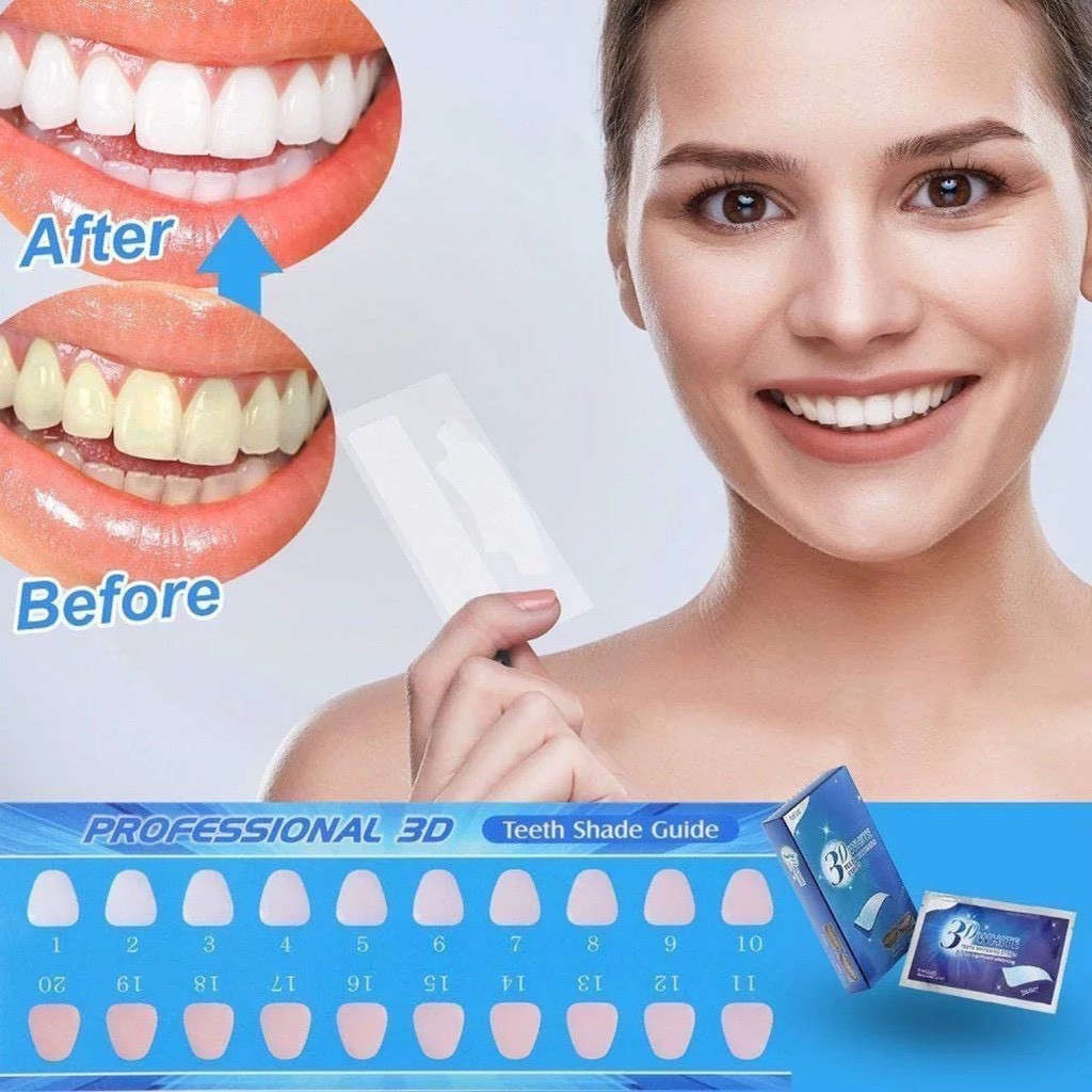 Miếng Dán Trắng Răng Tiện Lợi 3D White Teeth Whitening Strips - Vietfarm