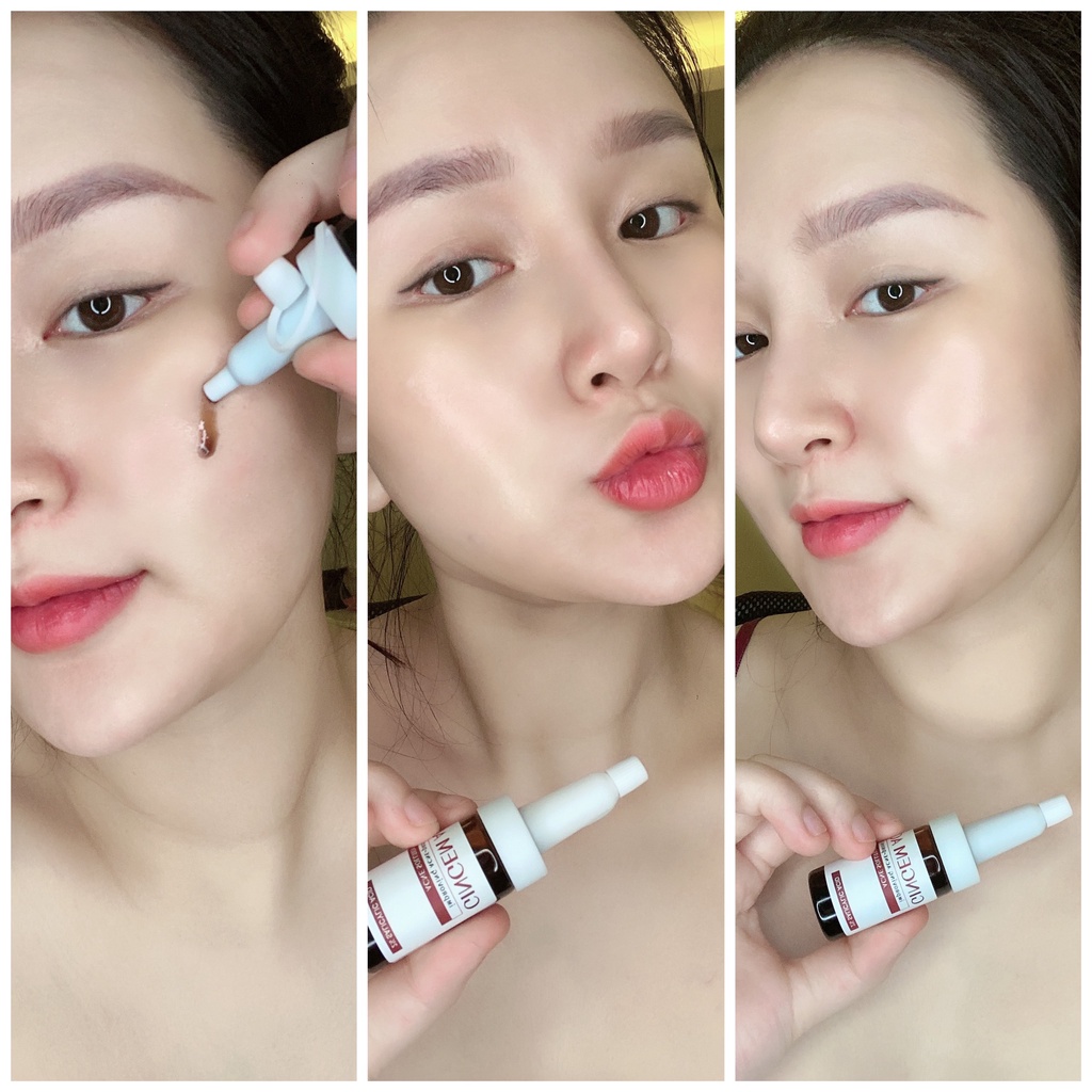 Gingem Haki  Mụn, Sáng Da