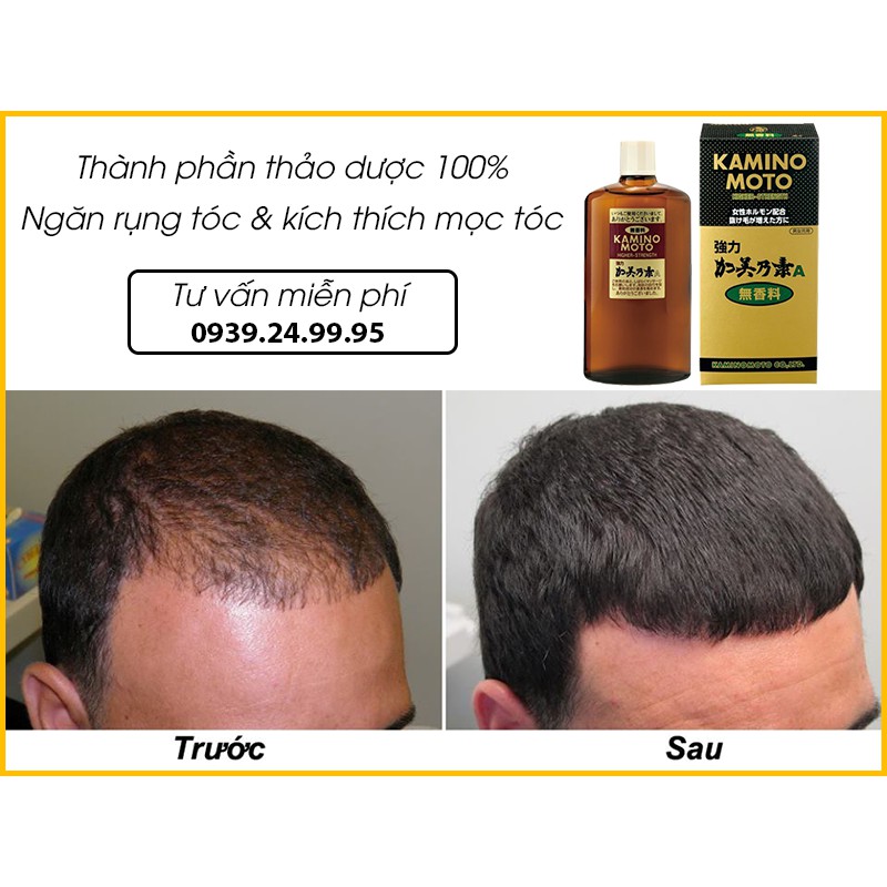 Sản phẩm mọc tóc Kaminomoto Higher Strength
