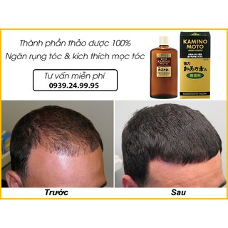 Serum mọc tóc Kaminomoto Nhật Bản công thức mạnh ,💥HÀNG CAO CẤP CHÍNH HÃNG💥 chống rụng hói, kích tóc mọc rậm hiệu quả.