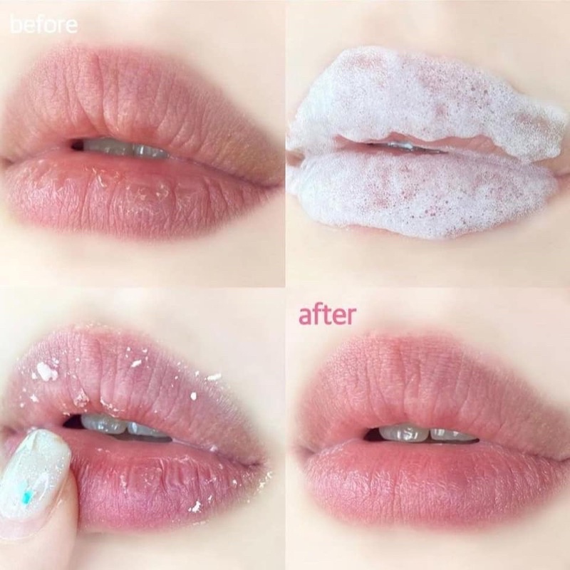 [Mã SKAMLTSM9 giảm 10% đơn 99K] TẨY DA CHẾT MÔI SỦI BỌT BUBI BUBI LIP BY UNPA