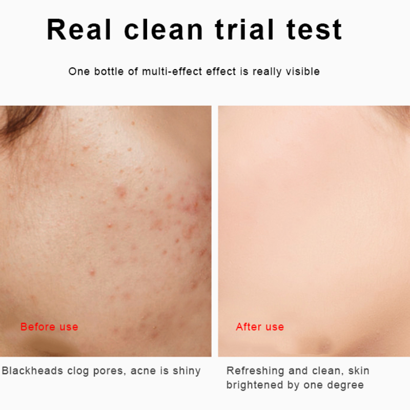 [Hàng mới về] Mặt nạ bùn trà xanh làm sạch sâu làn da kiềm dầu se khít lỗ chân lông