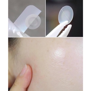 Miếng dán mụn Cosrx Acne Pimple Master Patch (Đỏ-Đen)