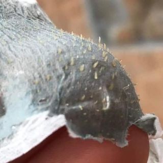 GELL LỘT MỤN
