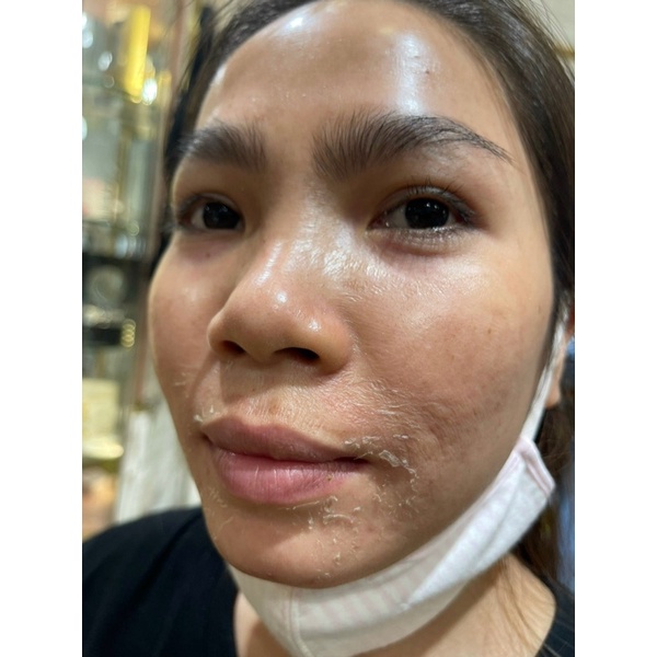 Peel Da Vi Tảo Retinol Trang Nemo Hàng Chính Hãng Hàn Quốc