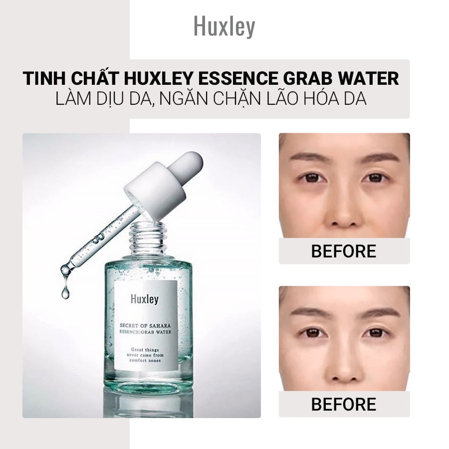 Bộ Dưỡng Da Cấp Ẩm Dành Cho Da Dầu Huxley Hydration Trio Set