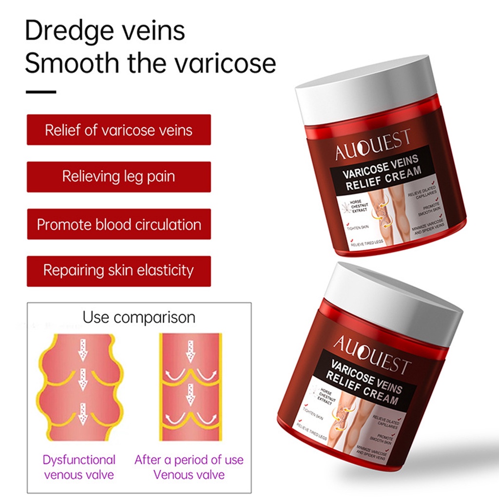 Kem Chiết Xuất Từ Gừng Tự Nhiên 80g Giúp Giảm Giãn Tĩnh Mạch Hiệu Quả