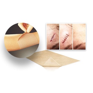 Miếng dán sẹo: Miếng dán sẹo Mepiform 4x30cm (Molnlycke – Thụy Điển)