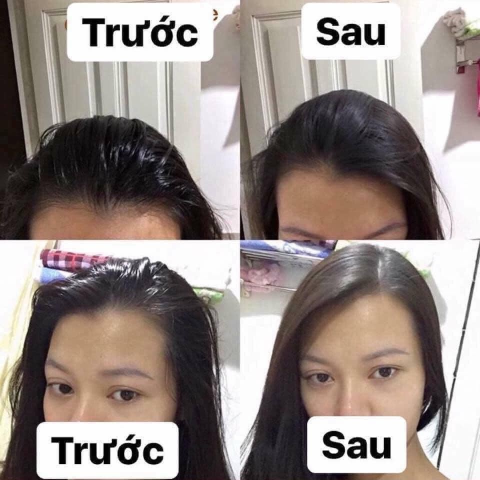 Haxaki Dầu gội khô Issy hàng nội địa Trung