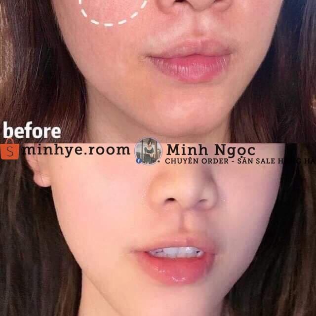 Viên Uống Collagen, Viên Uống Cấp Nước IHC 2In1 Sự Kết Hợp Tuyệt Vời Cho Da Cực Kì Hiệu Quả Vừa Chống Già Vừa Căng Da | BigBuy360 - bigbuy360.vn